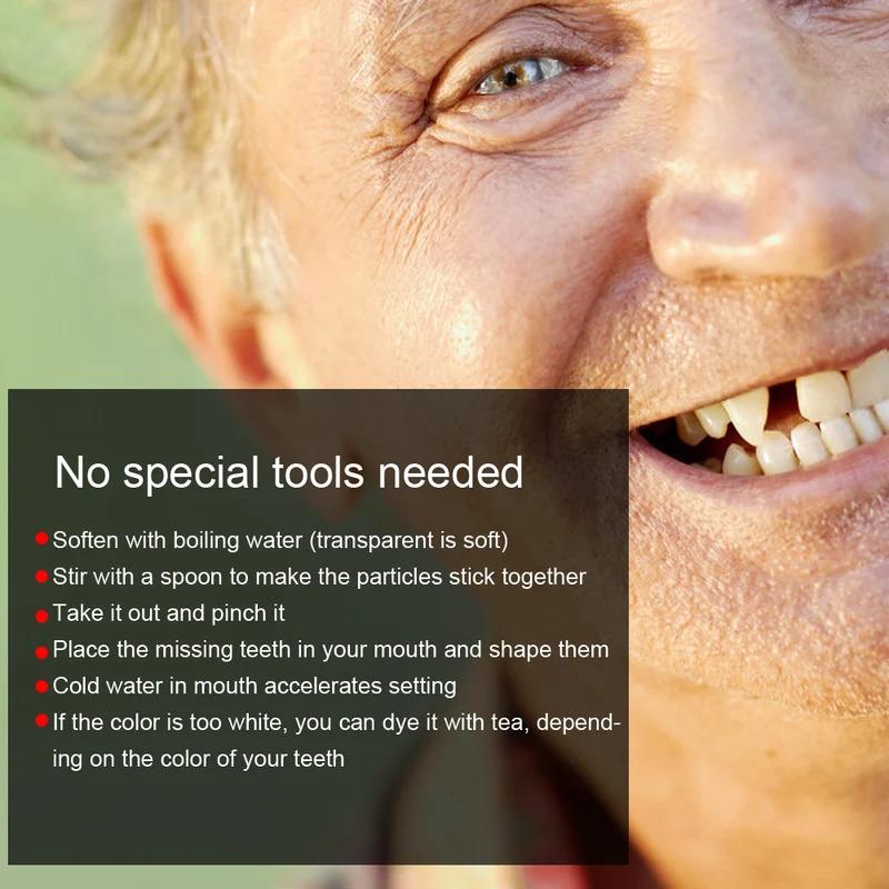 Broken Teeth Repair Temporary Tooth Repair Beads for Missing Broken Teeth Dental Tooth Filling Material