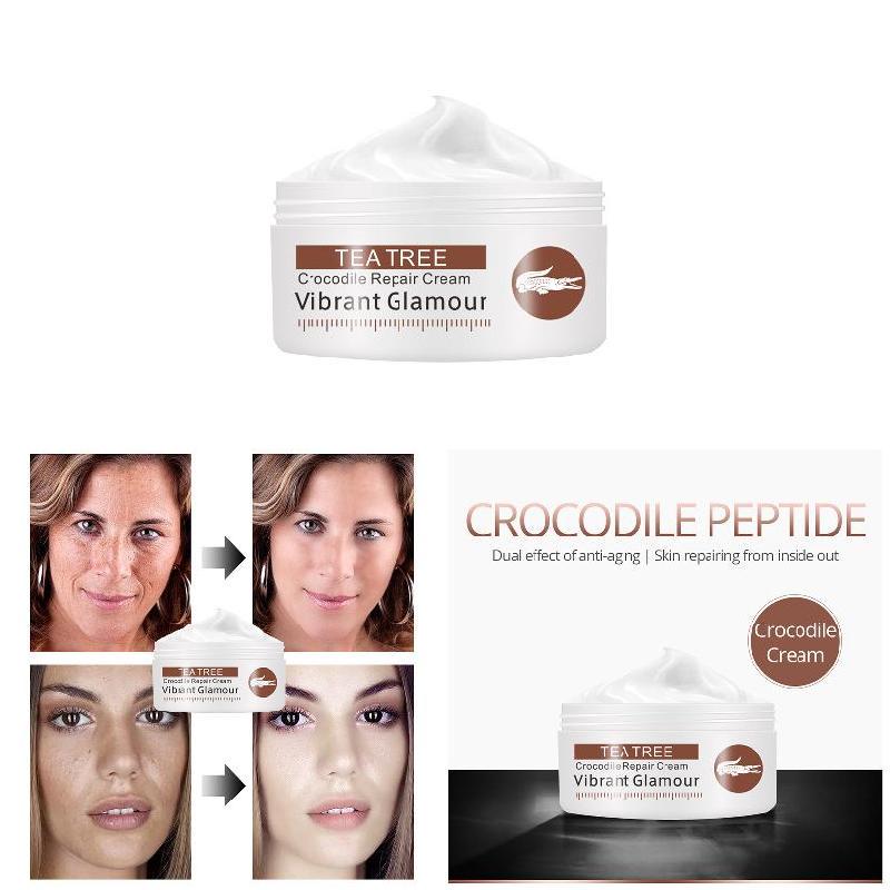 crocodile cream for stretch marks