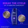 Head & Shoulders Clinical Strength Dandruff Defense Advanced Oil Control Shampoo 2pcs 800ml