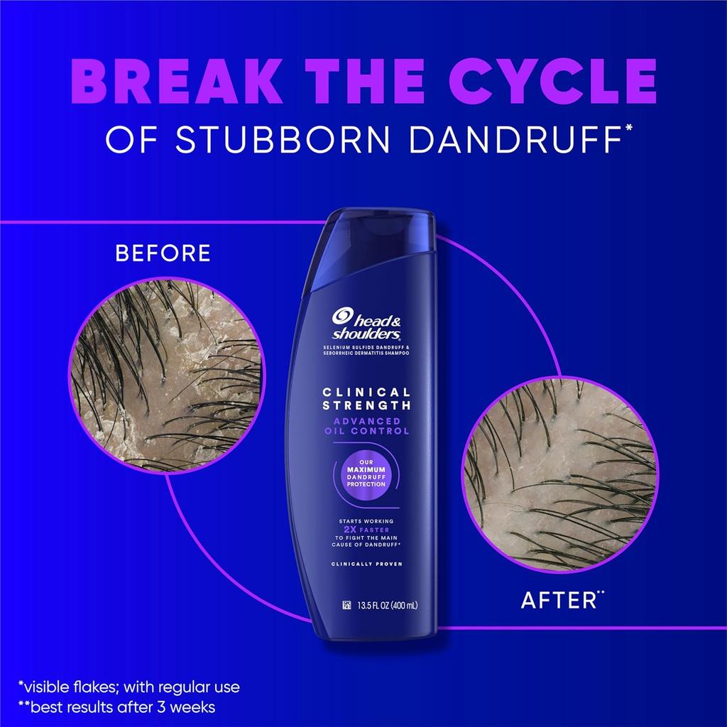 Head & Shoulders Clinical Strength Dandruff Defense Advanced Oil Control Shampoo 2pcs 800ml
