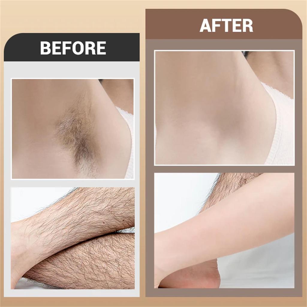 Multizone Soft Depilatory Cream 120 G ,Body And Facial Hair Removal Cream For Sensitive Skin ,Gentle For All Skin Type