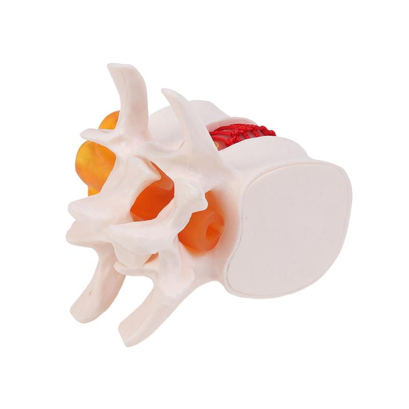 Menselijke Anatomie Skelet Wervelkolom Hernia Lumbalis Onderwijsmodel Hersenen Schedel Traumatisch Schoolbenodigdheden Medisch Instrument