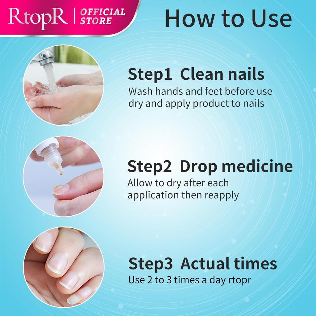 RtopR Ingwer-Nagelreparatur, ätherisches Öl für die Zehennägel