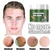 Effective Acne Removal Cream Treatment Acne Scar Shrink Pores Oil Control Whitening Moisturize Face