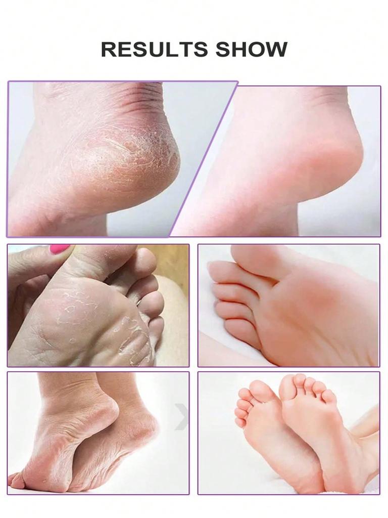 5/10 Packs Foot Peel Mask Deep Moisturizing Exfoliating Socks Soft Baby Feet Peeling Mask Foot Peel