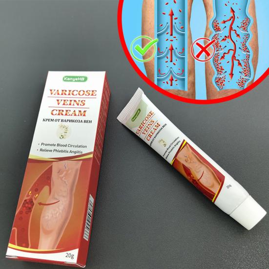 Yousheng 20g Veins Cream Quick Effect Relieve Itching Natural Varicose Vasculitis Phlebitis Spider Cream Plaster for Adult