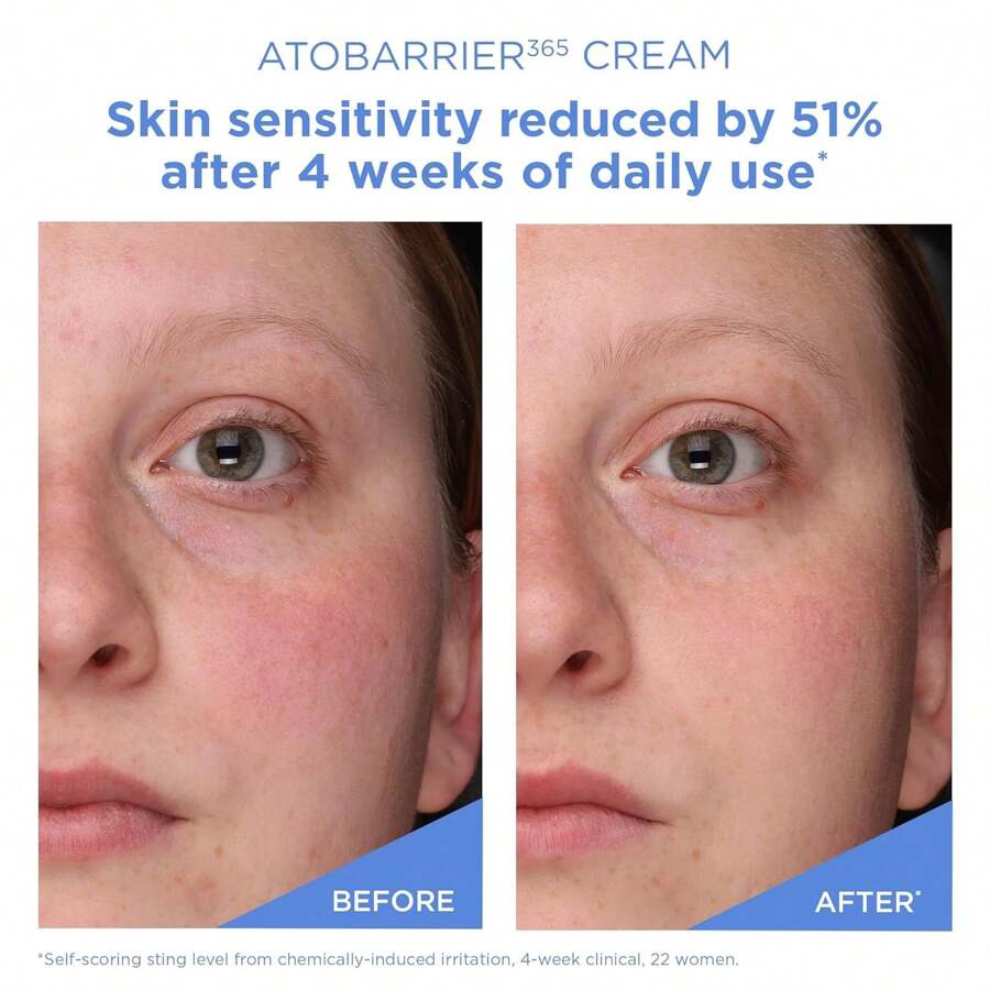 AESTURA ATOBARRIER365 Creme Mit Ceramiden 80 ML, Koreanische Feuchtigkeitscreme Zur Reparatur Der Hautbarriere | Lang Anhaltende Feuchtigkeit, Ceramid-Kapseln