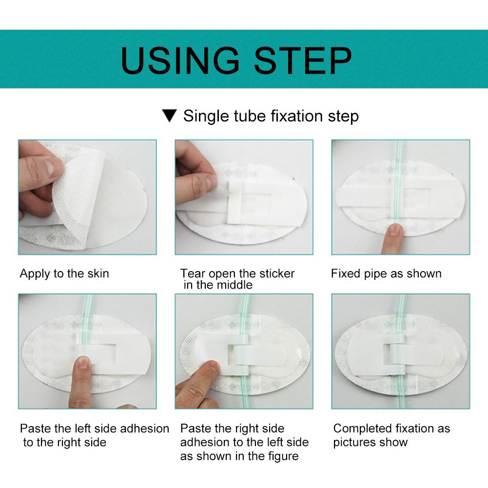 Body Surface Catheter Fixation Devices Non Woven Fabric Infusion Tube Fixed Paste