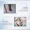 Wireless High-Definition Scalp & Hair Analyzer