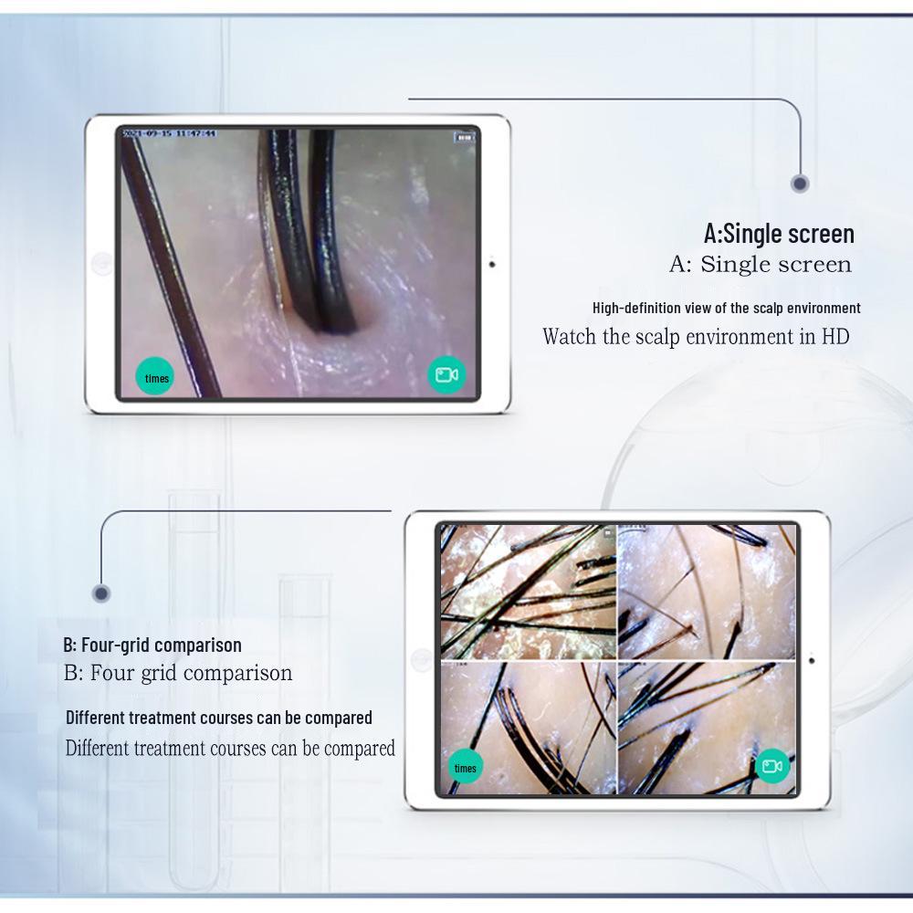 Wireless High-Definition Scalp & Hair Analyzer