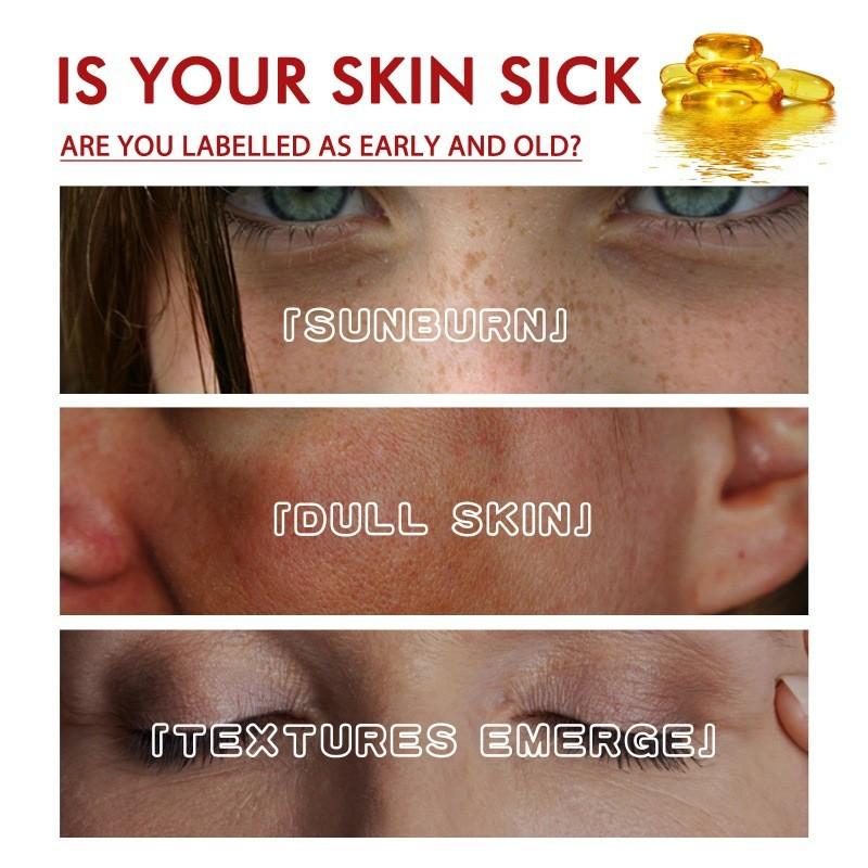 West Month Black Spot Repair Cream Hydrating Moisturizing Foundation For Flawless Skin