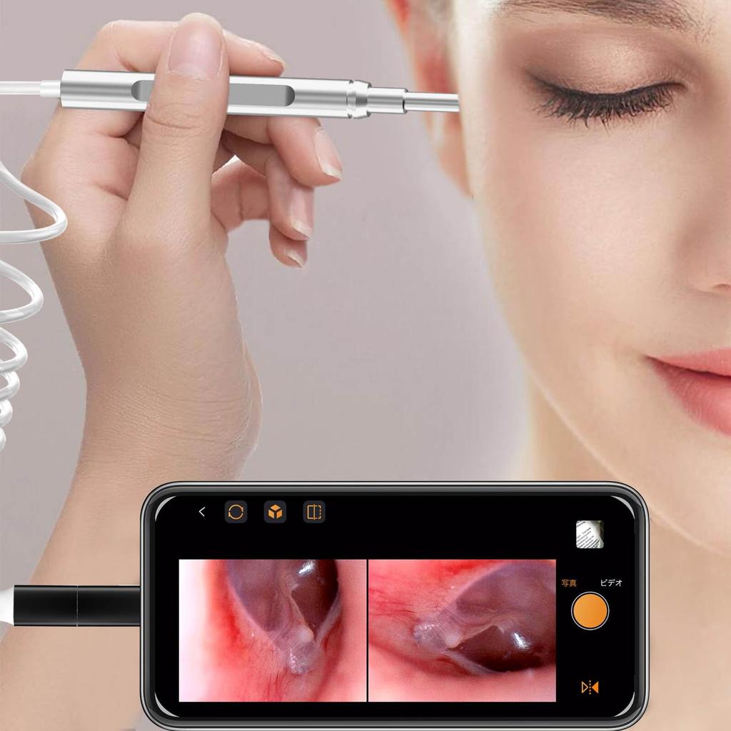 AMTORIN Camera Earpick Compatible with iPhone and Android Earpick No Earscope Camera with Photo and Video Suitable for Elderly and Compatible with