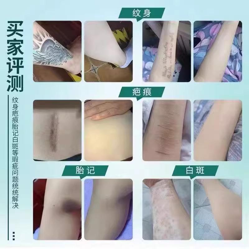 Abdeckungs-Tattoo-Aufkleber Ultradünn Wasserdicht Narbenabdeckung Unsichtbar Hautfarben Muttermal Narbenartefakt Natürlicher Abdeckungsaufkleber