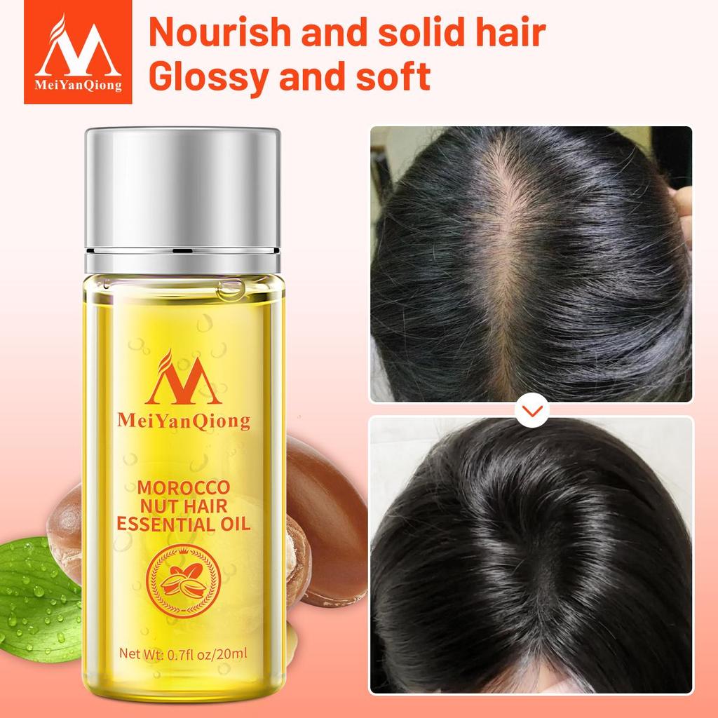 Oli Essenziali per la Cura dei Capelli da Noci Nutrire Riparare i Capelli Follicoli Capillari Capelli Flessibili e Luminosi Essenza per Capelli