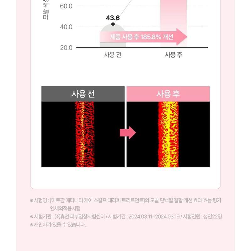 ATOPALM - Maternity Scalp Therapy Treatment