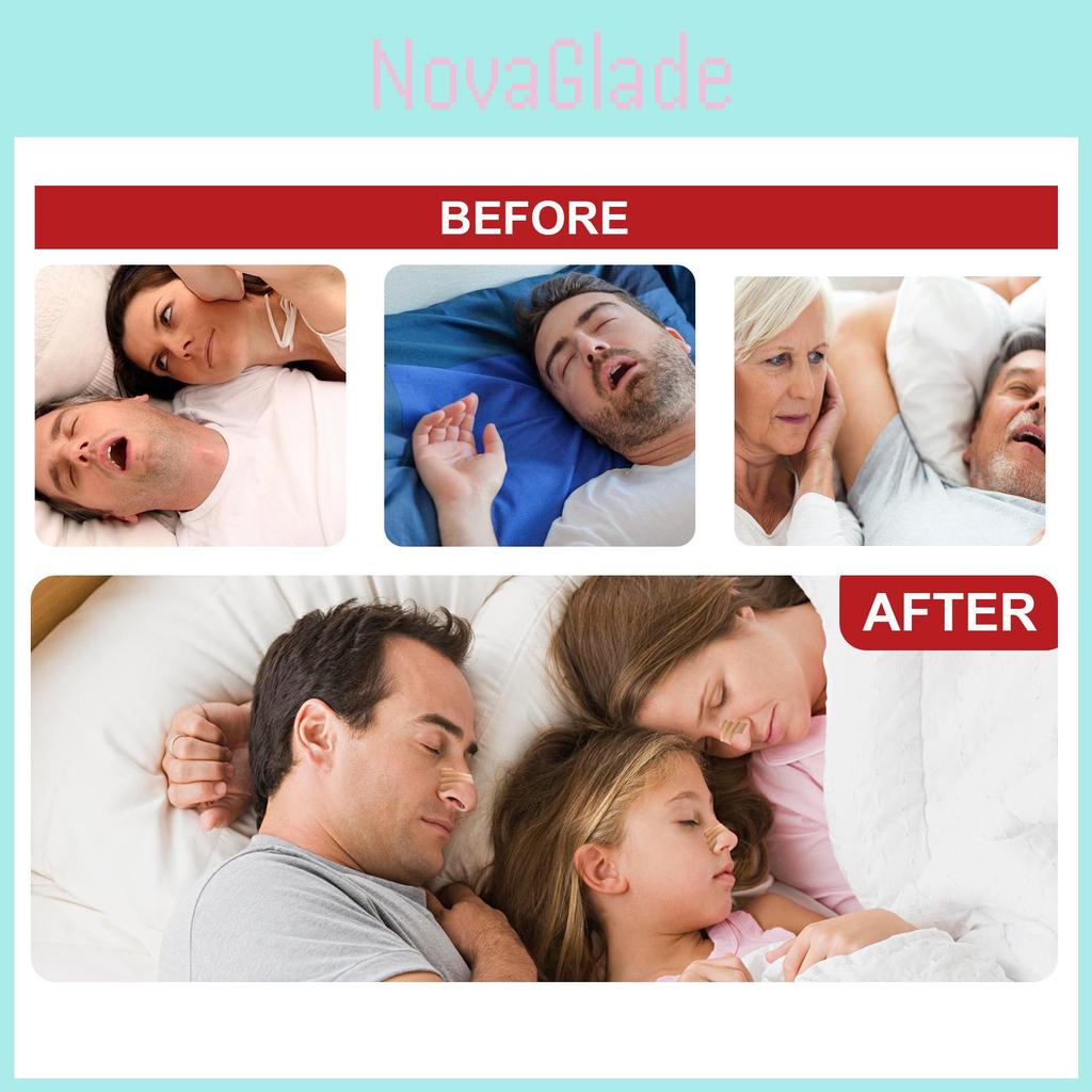 Ximonth Zachte Neuspleisters voor Comfortabele Verzorging en Verlichting van Neusklachten 75 stuks