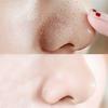 10 Pcs Nose Blackhead Remover Mask Deep Cleansing Skin Care Shrink Pore Acne Treatment Mask Nose Black dots Pore Clean Strips