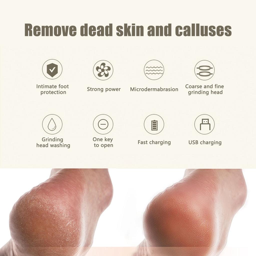 Electric Foot Pedicure Device Rechargeable Feet Callus Remover Plastic Foot File Tools Pink