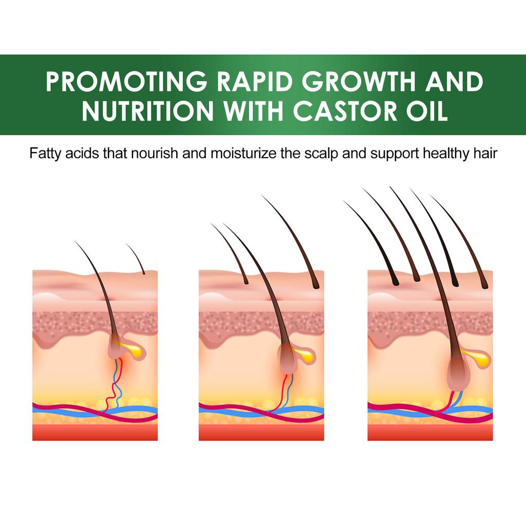Eelhoe Castor Oil Hair Growth Serum Rich Nourishing Scalp Massage Treatment 60ml Set