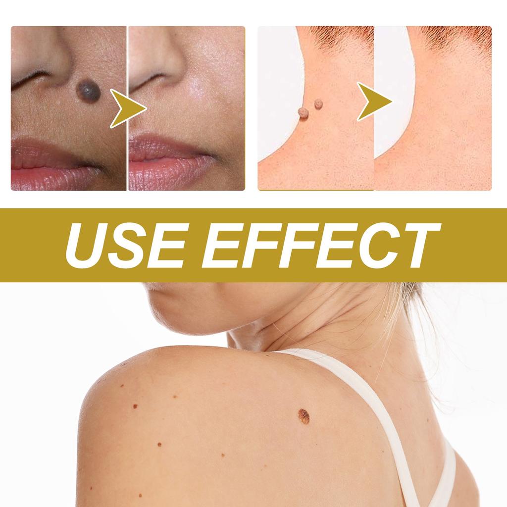 Bee Relief Ointment, Bee  Gel, And Bee  Can Remove Skin Pimples Without Irritation Or Traces,20ML