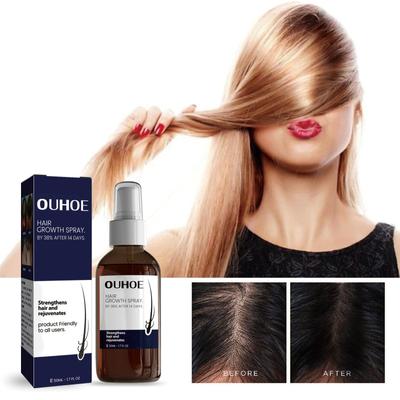 Hair Growth Spray,  And Hair Thickening Spray, Hair Regrowth For Women & Men