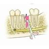 GDC Root Elevators Seldin Standard (E1r)