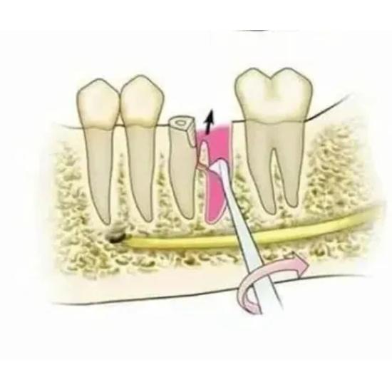 GDC Root Elevators Seldin Standard (E1r)