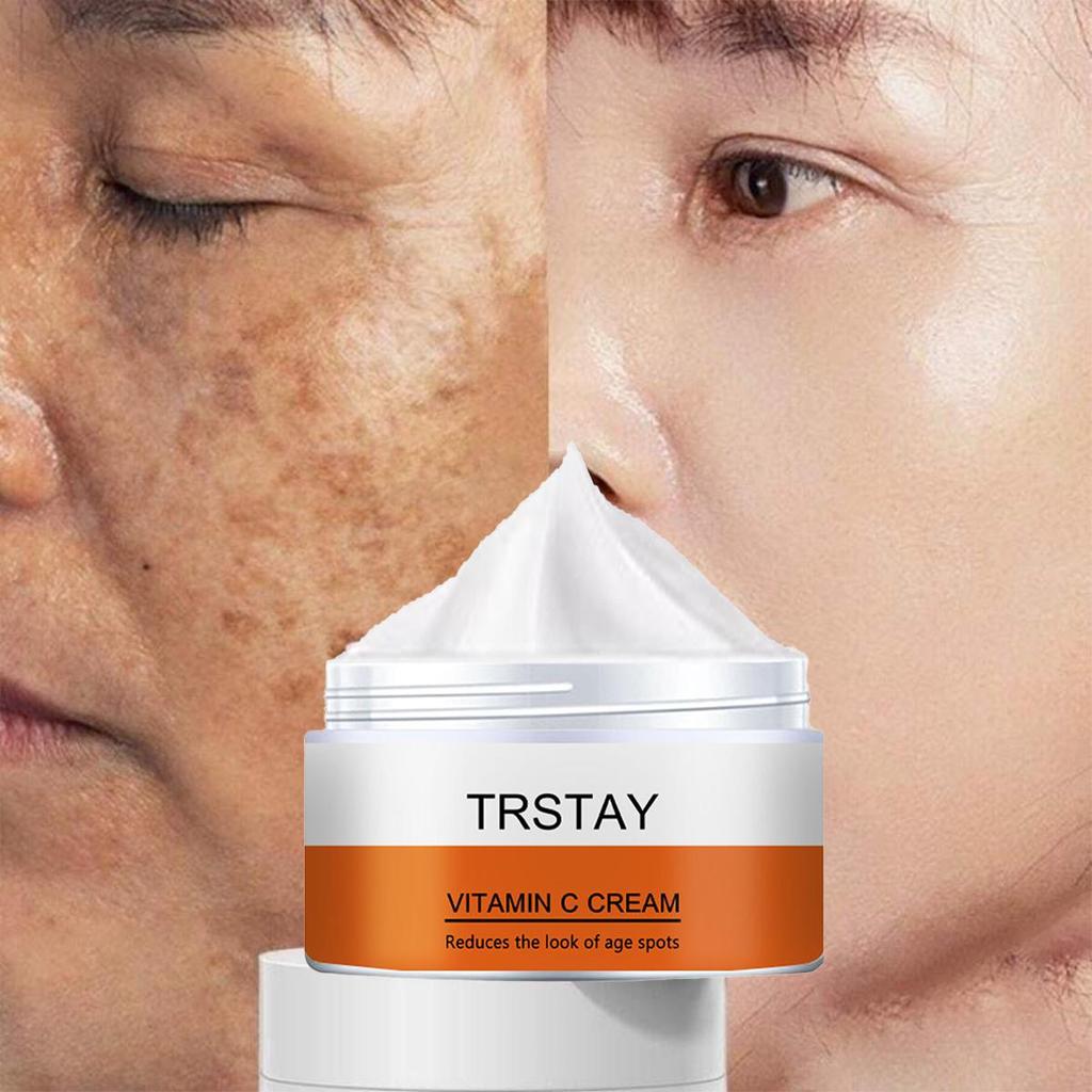 TRSTAY Vitamin C For Face Cream Pigments Dark Spots Removal Whitening Facial Cream Lightening Skin Care Products Beauty Health