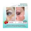 Cream for Melasma, Nourishing And Moisturizing Skin Face Anti-Wrinkle Reduces Dark Spots And Fine Lines