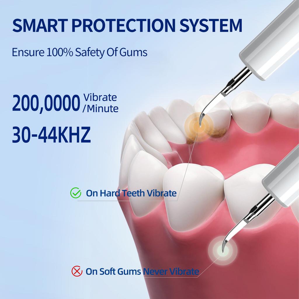 Electric Dental Scaler Ultrasonic Tooth Cleaner Household Tooth Stone Remover Tooth Whitening Oral Cleaning Tools