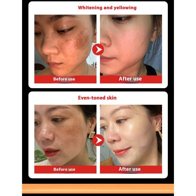 Whitening and Freckle Removing Cream Face Cream Lightening and Removing Spotles Sunburn Brightening Skin Color