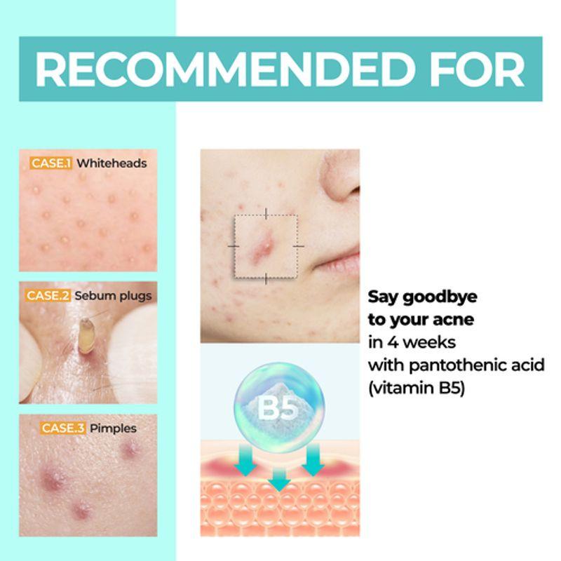 NUMBUZIN Nr. 1 Pantothensäure B5 Aktive Beruhigungscreme 80ml