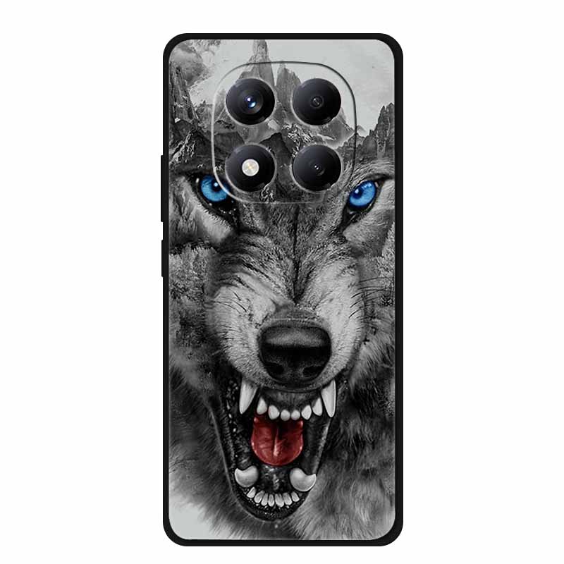 For Redmi Note 15 Case China Version 6.77" Camera Lens Protector Silicone Soft Cover Funda for Redmi Note 15 5G Coque New Note15