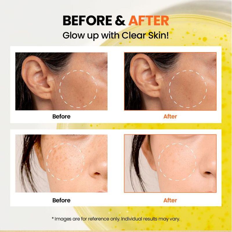 KSECRET - SEOUL 1988 Glow Serum : Niacinamide 15% + Yuja