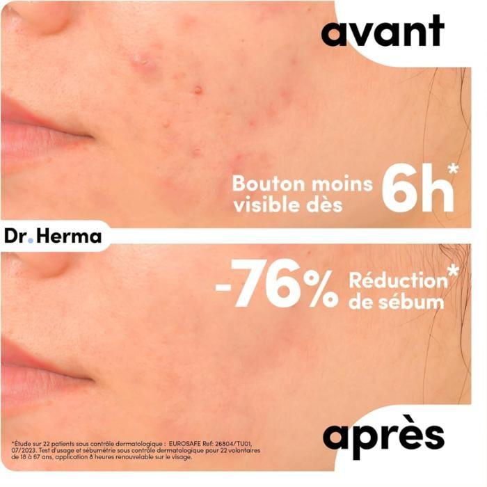 Patch Anti-Boutons - Dr. Herma - Format Large - 10 Patchs - Hypoallergénique - Résultats Rapides