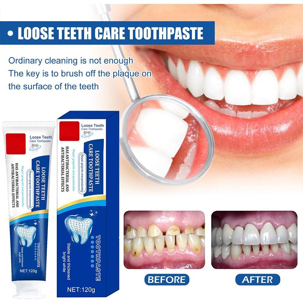 Quick Repair of Cavities Teeth Whitening Toothpaste Removal of Plaque Stains Decay Fresh Breath Repair Teeth Care Product 100g