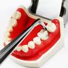 New Dental Matrix Bands Sectional Contoured Metal Matrices Matrix For Teeth Replacement Dentist Tools Dentistry Material
