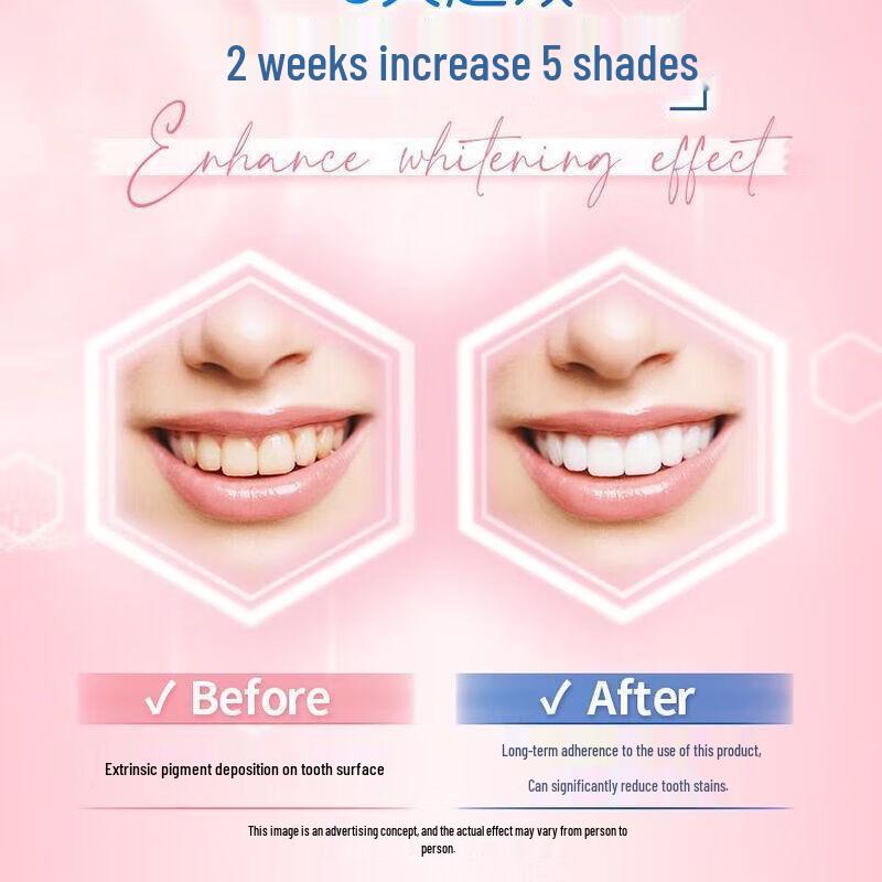 Lasuoling Aufhellende Zahnpasta für empfindliche Zähne