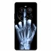 For Xiaomi 15 Ultra 5G Cases Bumper Black Silicone TPU Fashion Back Cover Cases For Xiaomi 15 Ultra 5G Protective Coque 15 Ultra