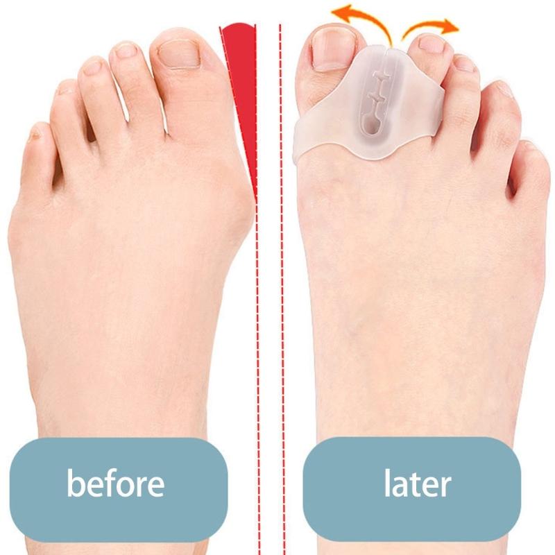 1 Pair Toe Spacers Bunions Corrector Toe Separators for Women and Men Big Toe Straightener Foot Toe Spreader