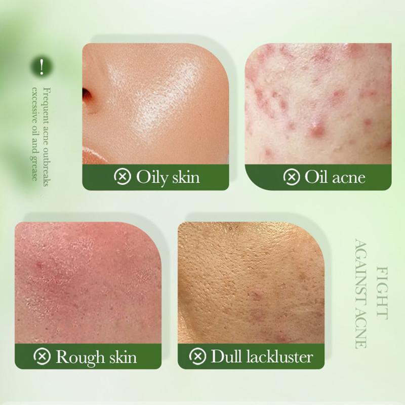 SADOER Green Tea Salicylic Acid Face Cream - Oil Control, Anti Acne, Water-Oil Balance & Deep Moisturizing for Smooth Skin