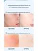 High-Concentration Niacinamide Essence: Brightens, Hydrates, Moisturizes, and Improves Skin Tone.