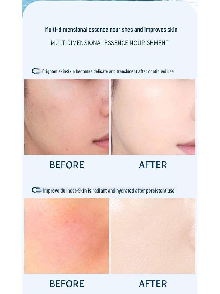High-Concentration Niacinamide Essence: Brightens, Hydrates, Moisturizes, and Improves Skin Tone.