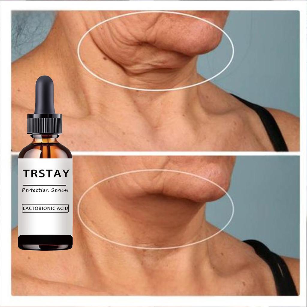 Vitamin C Retinol Firming Serum, Firming Lifting Essence, Softens Skin, Improves Elasticity, Smoothes Wrinkles, Skin Care Face Serum For Women