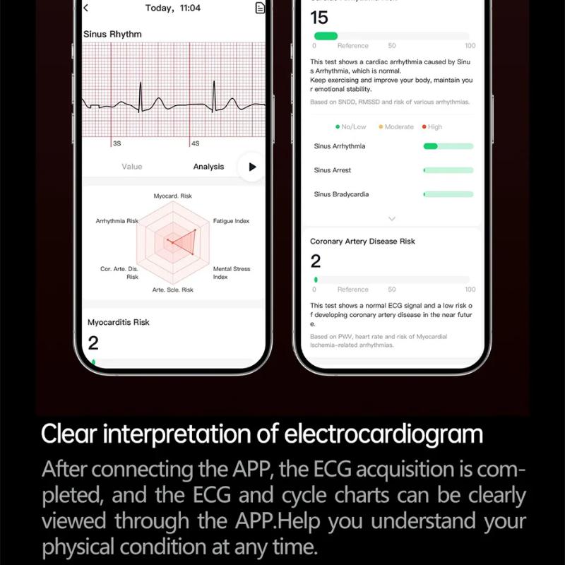 2025 Ny EKG+PPG Smartklokke Lipider Urinsyre Blodtrykk Helseklokke Menn NFC-tilgang 100+Sport HD Bluetooth Samtale Klokke Kvinner
