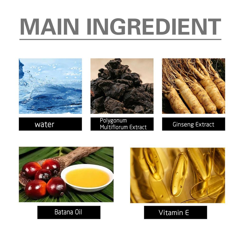 1 Set East Moon Hair Growth Essence with Roller ,Anti Hair Loss Essence Product, Rapid Treatment, Prevent Hair Thinning, Drying,Thick Hair Growth