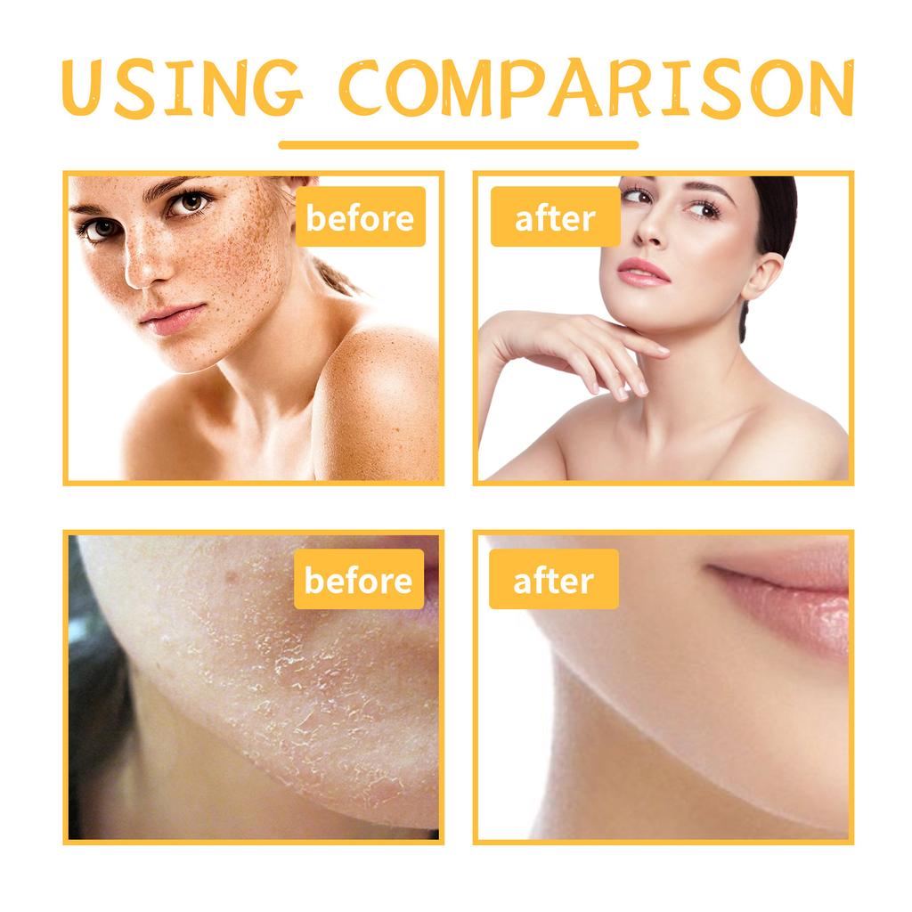 Turmeric Body Scrub Moisturizes The Skin, Deeply Cleanses and Provides A New Experience of Cleansing The Skin's Keratin and Melanin