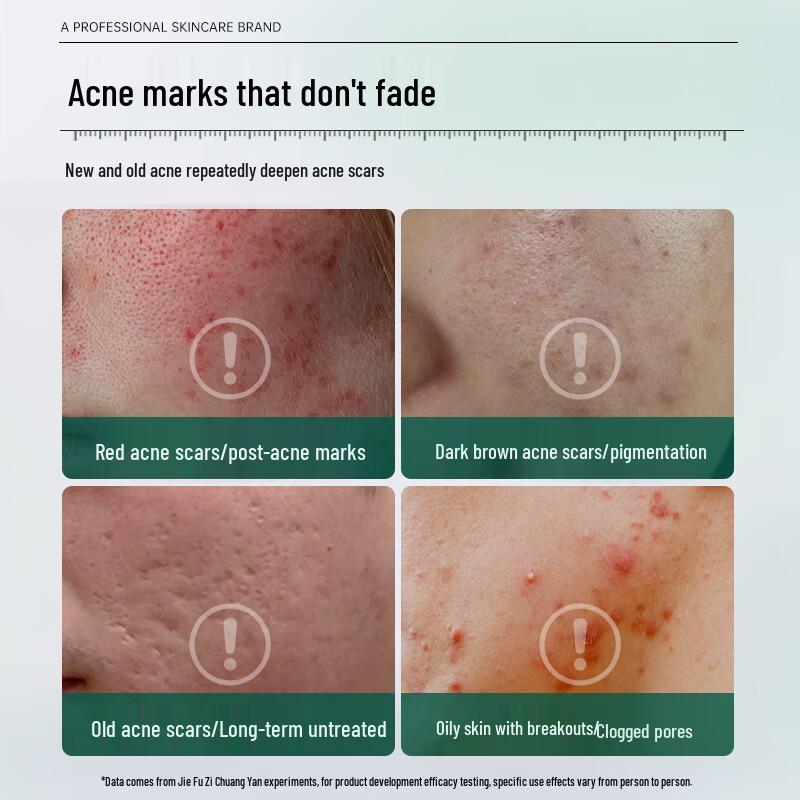 JAYFS Centella Asiatica Acne & Oil Control Cream