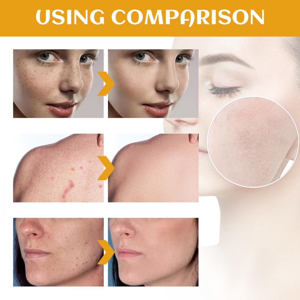 Intensive Spot Lightening Cleansing Milk for Deep Facial and Body Cleansing