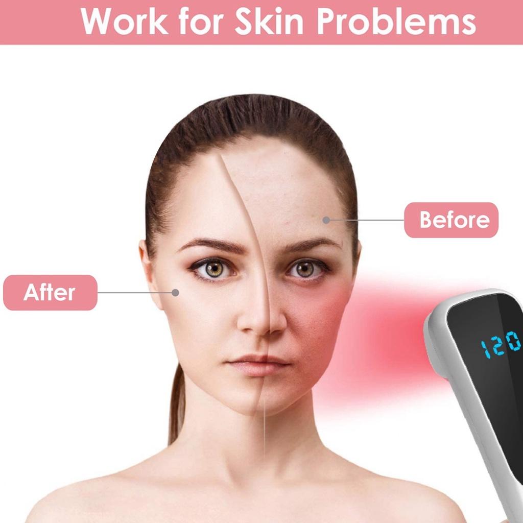 

3 Вт Белый светодиод Красный Инфракрасный Светотерапевтический Прибор 850 нм 660 нм для Облегчения Боли